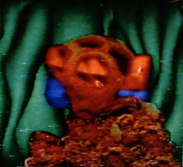 Implantation On the Mound, 1990. Digital image, Amiga 1000. 640x480px